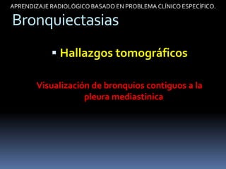 APRENDIZAJE RADIOLÓGICO BASADO EN PROBLEMA CLÍNICO ESPECÍFICO.

Bronquiectasias
             Hallazgos tomográficos

       Visualización de bronquios contiguos a la
                   pleura mediastinica
 