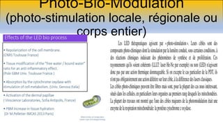 Photo-Bio-Modulation
(photo-stimulation locale, régionale ou
corps entier)
 