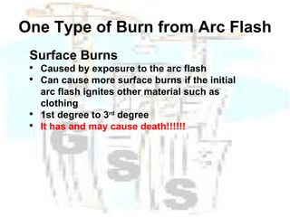 One Type of Burn from Arc Flash Surface Burns Caused by exposure to the arc flash  Can cause more surface burns if the initial arc flash ignites other material such as clothing 1st degree to 3 rd  degree It has and may cause death!!!!!! 