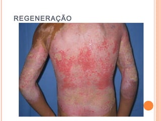 REGENERAÇÃO
 