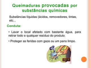 Queimaduras provocadas por
substâncias químicas
Substâncias líquidas (ácidos, removedores, tintas,
etc...
Conduta:
• Lavar o local afetado com bastante água, para
retirar todo e qualquer resíduo do produto.
• Proteger as feridas com gaze ou um pano limpo.
 