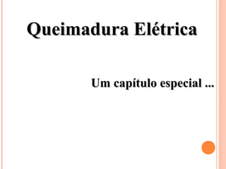 Queimadura ElétricaQueimadura Elétrica
Um capítulo especial ...Um capítulo especial ...
 