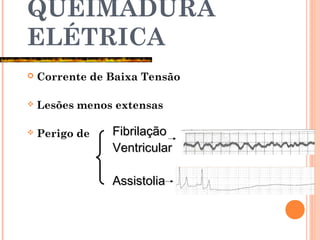 QUEIMADURA
ELÉTRICA
 Corrente de Baixa Tensão
 Lesões menos extensas
 Perigo de FibrilaçãoFibrilação
VentricularVentricular
AssistoliaAssistolia
 