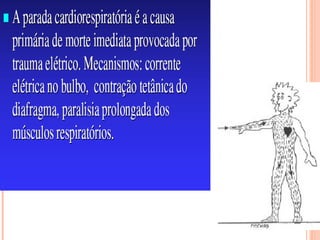 Queimaduras