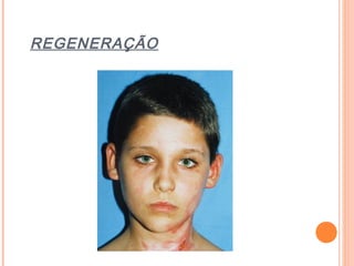 REGENERAÇÃO
 