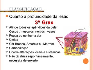  Quanto a profundidade da lesãoQuanto a profundidade da lesão
3º Grau3º Grau
 Atinge todos os apêndices da peleAtinge todos os apêndices da pele
Ossos , musculos, nervos , vasosOssos , musculos, nervos , vasos
 Pouca ou nenhuma dorPouca ou nenhuma dor
 ÚmidaÚmida
 Cor Branca, Amarela ou MarromCor Branca, Amarela ou Marrom
 CarbonizaçãoCarbonização
 Ocorre alterações locais e sistêmicasOcorre alterações locais e sistêmicas
 Não cicatriza espontaneamente,Não cicatriza espontaneamente,
necessita de enxertonecessita de enxerto
CLASSIFICAÇÃO
 
