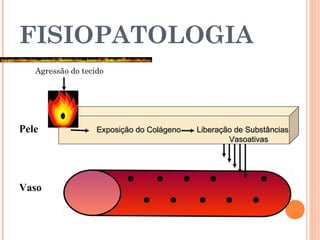 FISIOPATOLOGIA
Agressão do tecido
Vaso
Pele Exposição do ColágenoExposição do Colágeno Liberação de SubstânciasLiberação de Substâncias
VasoativasVasoativas
 