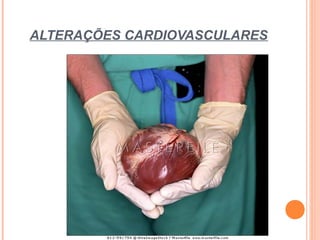 ALTERAÇÕES CARDIOVASCULARES
 