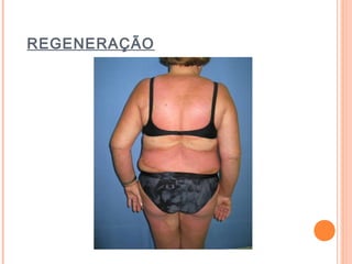 REGENERAÇÃO
 