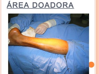 ÁREA DOADORA
 