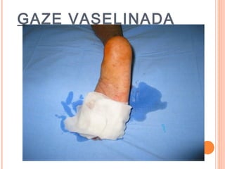 GAZE VASELINADA
 
