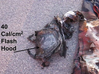 © ABB
2/07/2012 | Slide 14
40
Cal/cm2
Flash
Hood
 