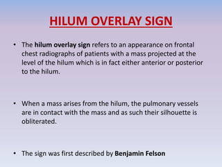 HILUM OVERLAY SIGN
• The hilum overlay sign refers to an appearance on frontal
chest radiographs of patients with a mass projected at the
level of the hilum which is in fact either anterior or posterior
to the hilum.
• When a mass arises from the hilum, the pulmonary vessels
are in contact with the mass and as such their silhouette is
obliterated.
• The sign was first described by Benjamin Felson
 