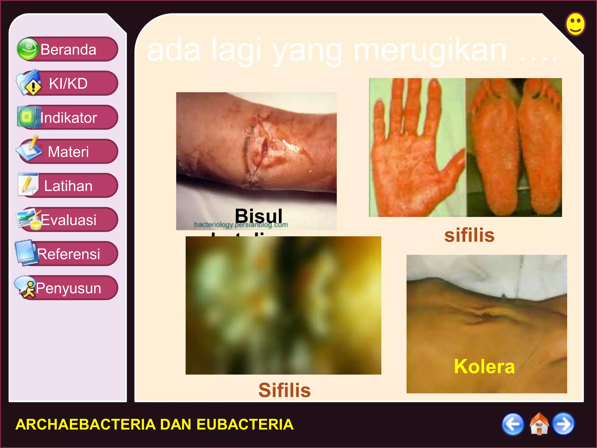 Beranda 
KI/KD 
Indikator 
Materi 
Latihan 
Evaluasi 
Referensi 
Penyusun 
ada lagi yang merugikan …. 
Bisul 
botulinum 
ARCHAEBACTERIA DAN EUBACTERIA 
Kolera 
Sifilis 
sifilis 
 