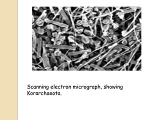 Scanning electron micrograph, showing
Korarchaeota.
 