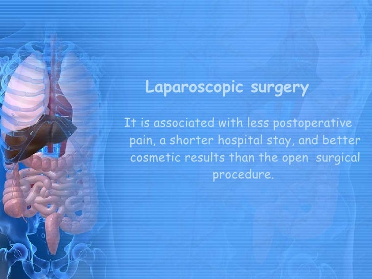 Laparoscopic Cholecystectomy