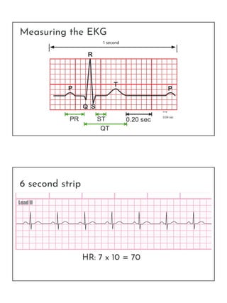 Measuring the EKG
0.04 sec
1 second
6 second strip
HR: 7 x 10 = 70
 