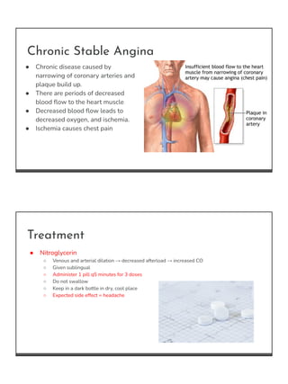 Chronic Stable Angina
● Chronic disease caused by
narrowing of coronary arteries and
plaque build up.
● There are periods ...