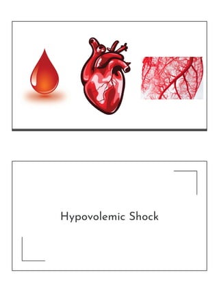Hypovolemic Shock
 