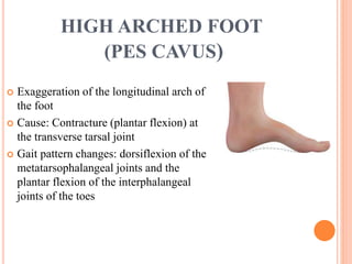 HIGH ARCHED FOOT
(PES CAVUS)
 Exaggeration of the longitudinal arch of
the foot
 Cause: Contracture (plantar flexion) at
the transverse tarsal joint
 Gait pattern changes: dorsiflexion of the
metatarsophalangeal joints and the
plantar flexion of the interphalangeal
joints of the toes
 