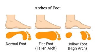 Arches of Foot
 