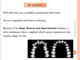 100
NiTi arch wires are available in preformed arch forms.
An over expanded arch form is selected.
Because of its Shape Memory and Superelasticity features, a
slow continuous force is applied which causes expansion to the
original shape of wire.
Niti archwires
DrRavikanthLakkakula
 