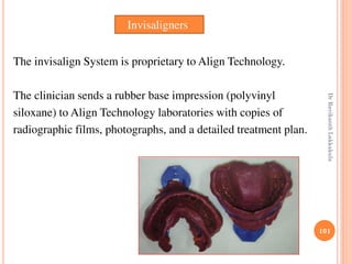 101
The invisalign System is proprietary to Align Technology.
The clinician sends a rubber base impression (polyvinyl
siloxane) to Align Technology laboratories with copies of
radiographic films, photographs, and a detailed treatment plan.
Invisaligners
DrRavikanthLakkakula
 