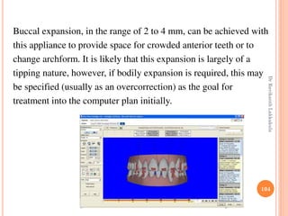 104
Buccal expansion, in the range of 2 to 4 mm, can be achieved with
this appliance to provide space for crowded anterior teeth or to
change archform. It is likely that this expansion is largely of a
tipping nature, however, if bodily expansion is required, this may
be specified (usually as an overcorrection) as the goal for
treatment into the computer plan initially.
DrRavikanthLakkakula
 