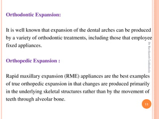 11
Orthodontic Expansion:
It is well known that expansion of the dental arches can be produced
by a variety of orthodontic treatments, including those that employee
fixed appliances.
Orthopedic Expansion :
Rapid maxillary expansion (RME) appliances are the best examples
of true orthopedic expansion in that changes are produced primarily
in the underlying skeletal structures rather than by the movement of
teeth through alveolar bone.
DrRavikanthLakkakula
 