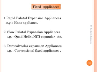 13
1.Rapid Palatal Expansion Appliances
e.g. : Haas appliance.
2. Slow Palatal Expansion Appliances
e.g. : Quad Helix ,NiTi expander etc.
3. Dentoalveolar expansion Appliances
e.g. : Conventional fixed appliances .
Fixed Appliances
DrRavikanthLakkakula
 