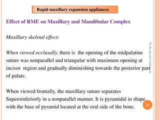 15
Effect of RME on Maxillary and Mandibular Complex
Maxillary skeletal effect:
When viewed occlusally, there is the opening of the midpalatine
suture was nonparallel and triangular with maximum opening at
incisor region and gradually diminishing towards the posterior part
of palate.
When viewed frontally, the maxillary suture separates
Superoinferiorly in a nonparallel manner. It is pyramidal in shape
with the base of pyramid located at the oral side of the bone.
Rapid maxillary expansion appliances
DrRavikanthLakkakula
 