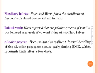 16
Maxillary halves : Haas and Wertz found the maxilla to be
frequently displaced downward and forward.
Palatal vault: Haas reported that the palatine process of maxilla
was lowered as a result of outward tilting of maxillary halves.
Alveolar process : Because bone is resilient, lateral bending
of the alveolar processes occurs early during RME, which
rebounds back after a few days.
DrRavikanthLakkakula
 