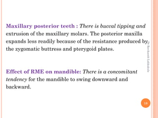 18
Maxillary posterior teeth : There is buccal tipping and
extrusion of the maxillary molars. The posterior maxilla
expands less readily because of the resistance produced by
the zygomatic buttress and pterygoid plates.
Effect of RME on mandible: There is a concomitant
tendency for the mandible to swing downward and
backward.
DrRavikanthLakkakula
 