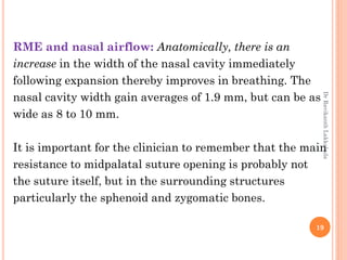 19
RME and nasal airflow: Anatomically, there is an
increase in the width of the nasal cavity immediately
following expansion thereby improves in breathing. The
nasal cavity width gain averages of 1.9 mm, but can be as
wide as 8 to 10 mm.
It is important for the clinician to remember that the main
resistance to midpalatal suture opening is probably not
the suture itself, but in the surrounding structures
particularly the sphenoid and zygomatic bones.
DrRavikanthLakkakula
 