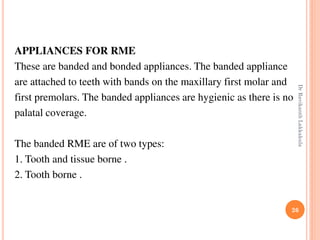 26
APPLIANCES FOR RME
These are banded and bonded appliances. The banded appliance
are attached to teeth with bands on the maxillary first molar and
first premolars. The banded appliances are hygienic as there is no
palatal coverage.
The banded RME are of two types:
1. Tooth and tissue borne .
2. Tooth borne .
DrRavikanthLakkakula
 