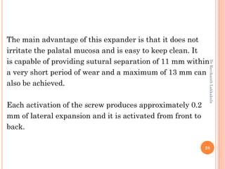 28
The main advantage of this expander is that it does not
irritate the palatal mucosa and is easy to keep clean. It
is capable of providing sutural separation of 11 mm within
a very short period of wear and a maximum of 13 mm can
also be achieved.
Each activation of the screw produces approximately 0.2
mm of lateral expansion and it is activated from front to
back.
DrRavikanthLakkakula
 