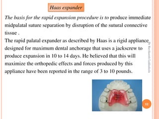 32
The basis for the rapid expansion procedure is to produce immediate
midpalatal suture separation by disruption of the sutural connective
tissue .
The rapid palatal expander as described by Haas is a rigid appliance
designed for maximum dental anchorage that uses a jackscrew to
produce expansion in 10 to 14 days. He believed that this will
maximize the orthopedic effects and forces produced by this
appliance have been reported in the range of 3 to 10 pounds.
Haas expander
DrRavikanthLakkakula
 
