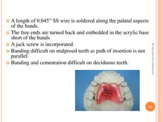 33
 A length of 0.045” SS wire is soldered along the palatal aspects
of the bands.
 The free ends are turned back and embedded in the acrylic base
short of the bands
 A jack screw is incorporated.
 Banding difficult on malposed teeth as path of insertion is not
parallel.
 Banding and cementation difficult on deciduous teeth.
DrRavikanthLakkakula
 