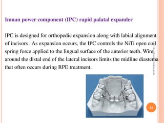 35
Inman power component (IPC) rapid palatal expander
IPC is designed for orthopedic expansion along with labial alignment
of incisors . As expansion occurs, the IPC controls the NiTi open coil
spring force applied to the lingual surface of the anterior teeth. Wire
around the distal end of the lateral incisors limits the midline diastema
that often occurs during RPE treatment.
DrRavikanthLakkakula
 