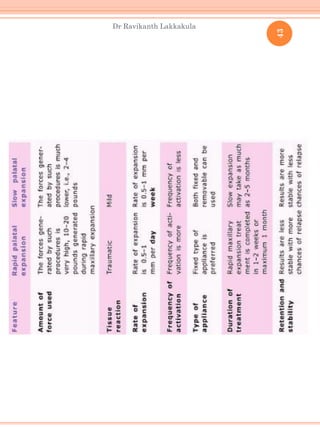 43
Dr Ravikanth Lakkakula
 