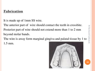 46
Fabrication
It is made up of 1mm SS wire.
The anterior part of wire should contact the teeth in crossbite.
Posterior part of wire should not extend more than 1 to 2 mm
beyond molar bands.
The wire is away form marginal gingiva and palatal tissue by 1 to
1.5 mm.
DrRavikanthLakkakula
 