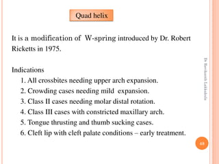 48
It is a modification of W-spring introduced by Dr. Robert
Ricketts in 1975.
Indications
1. All crossbites needing upper arch expansion.
2. Crowding cases needing mild expansion.
3. Class II cases needing molar distal rotation.
4. Class III cases with constricted maxillary arch.
5. Tongue thrusting and thumb sucking cases.
6. Cleft lip with cleft palate conditions – early treatment.
Quad helix
DrRavikanthLakkakula
 