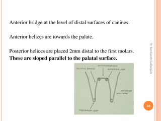 50
Anterior bridge at the level of distal surfaces of canines.
Anterior helices are towards the palate.
Posterior helices are placed 2mm distal to the first molars.
These are sloped parallel to the palatal surface.
DrRavikanthLakkakula
 