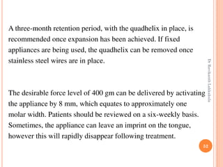 52
A three-month retention period, with the quadhelix in place, is
recommended once expansion has been achieved. If fixed
appliances are being used, the quadhelix can be removed once
stainless steel wires are in place.
The desirable force level of 400 gm can be delivered by activating
the appliance by 8 mm, which equates to approximately one
molar width. Patients should be reviewed on a six-weekly basis.
Sometimes, the appliance can leave an imprint on the tongue,
however this will rapidly disappear following treatment.
DrRavikanthLakkakula
 