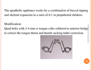 53
The quadhelix appliance works by a combination of buccal tipping
and skeletal expansion in a ratio of 6:1 in prepubertal children.
Modification:
Quad helix with 3-4 mm ss tongue cribs soldered to anterior bridge
to correct the tongue thrust and thumb sucking habit correction.
DrRavikanthLakkakula
 