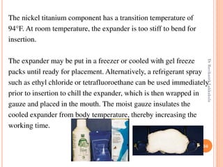 56
The nickel titanium component has a transition temperature of
94°F. At room temperature, the expander is too stiff to bend for
insertion.
The expander may be put in a freezer or cooled with gel freeze
packs until ready for placement. Alternatively, a refrigerant spray
such as ethyl chloride or tetrafluoroethane can be used immediately
prior to insertion to chill the expander, which is then wrapped in
gauze and placed in the mouth. The moist gauze insulates the
cooled expander from body temperature, thereby increasing the
working time.
DrRavikanthLakkakula
 