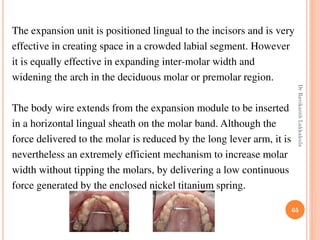 65
The expansion unit is positioned lingual to the incisors and is very
effective in creating space in a crowded labial segment. However
it is equally effective in expanding inter-molar width and
widening the arch in the deciduous molar or premolar region.
The body wire extends from the expansion module to be inserted
in a horizontal lingual sheath on the molar band. Although the
force delivered to the molar is reduced by the long lever arm, it is
nevertheless an extremely efficient mechanism to increase molar
width without tipping the molars, by delivering a low continuous
force generated by the enclosed nickel titanium spring.
DrRavikanthLakkakula
 