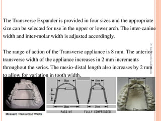 66
The Transverse Expander is provided in four sizes and the appropriate
size can be selected for use in the upper or lower arch. The inter-canine
width and inter-molar width is adjusted accordingly.
The range of action of the Transverse appliance is 8 mm. The anterior
transverse width of the appliance increases in 2 mm increments
throughout the series. The mesio-distal length also increases by 2 mm
to allow for variation in tooth width.
DrRavikanthLakkakula
 