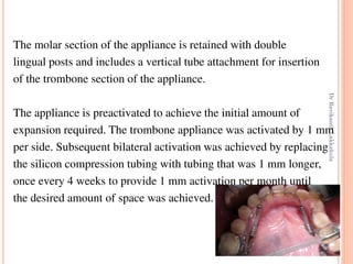 68
The molar section of the appliance is retained with double
lingual posts and includes a vertical tube attachment for insertion
of the trombone section of the appliance.
The appliance is preactivated to achieve the initial amount of
expansion required. The trombone appliance was activated by 1 mm
per side. Subsequent bilateral activation was achieved by replacing
the silicon compression tubing with tubing that was 1 mm longer,
once every 4 weeks to provide 1 mm activation per month until
the desired amount of space was achieved.
DrRavikanthLakkakula
 
