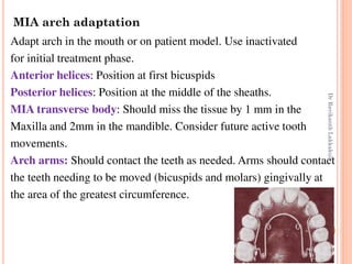 73
Adapt arch in the mouth or on patient model. Use inactivated
for initial treatment phase.
Anterior helices: Position at first bicuspids
Posterior helices: Position at the middle of the sheaths.
MIA transverse body: Should miss the tissue by 1 mm in the
Maxilla and 2mm in the mandible. Consider future active tooth
movements.
Arch arms: Should contact the teeth as needed. Arms should contact
the teeth needing to be moved (bicuspids and molars) gingivally at
the area of the greatest circumference.
MIA arch adaptation
DrRavikanthLakkakula
 